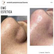 Estética Wanessa Chaves - Loures - Skin Cleansing
