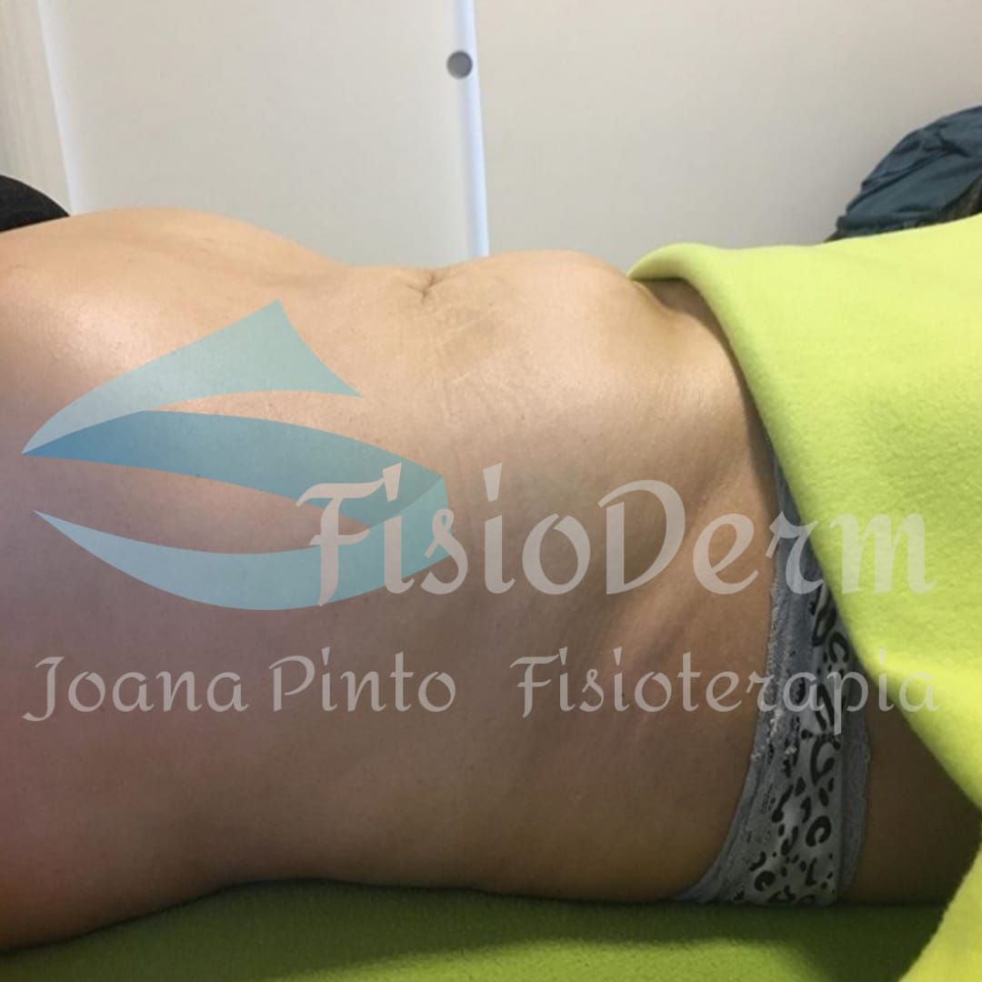 Joana Pinto FisioDerm - Vila Nova de Gaia - Massagem Terapêutica