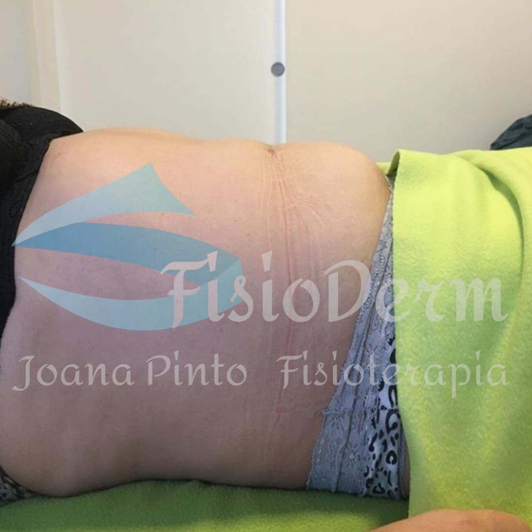 Joana Pinto FisioDerm - Vila Nova de Gaia - Massagem Profunda