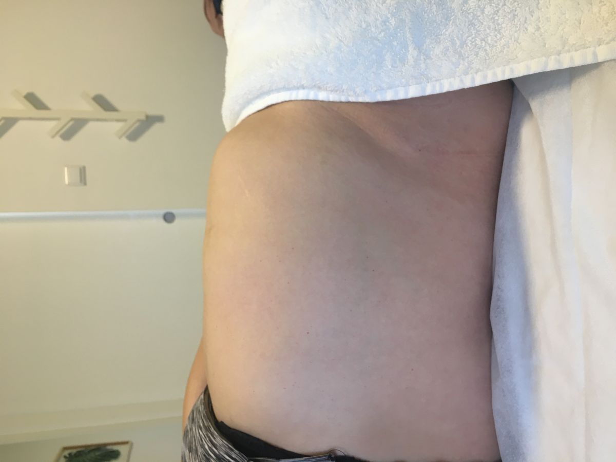 Joana Pinto FisioDerm - Vila Nova de Gaia - Sportmassage