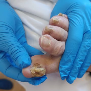 Medeiros clean - Leiria - Manicure and Pedicure