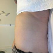 Joana Pinto FisioDerm - Vila Nova de Gaia - Sportmassage