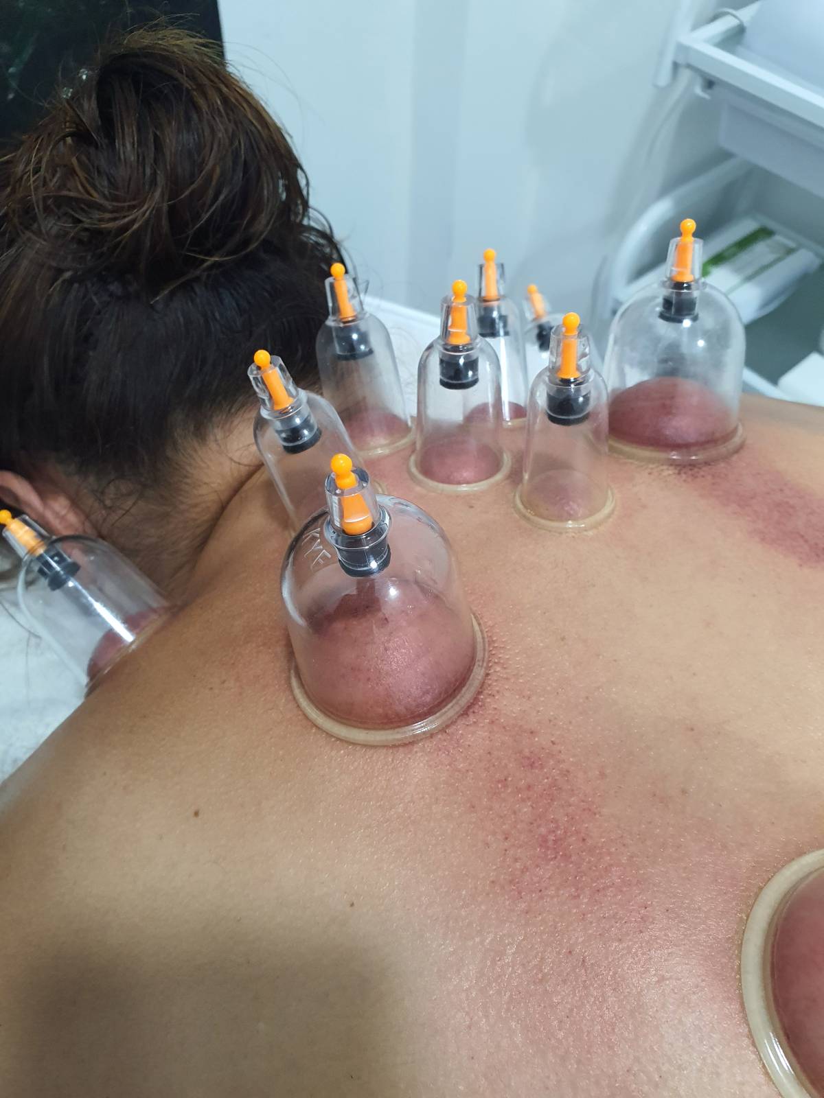 Sandra Tez MBS Therapies - Lisboa - Tratamento Facial