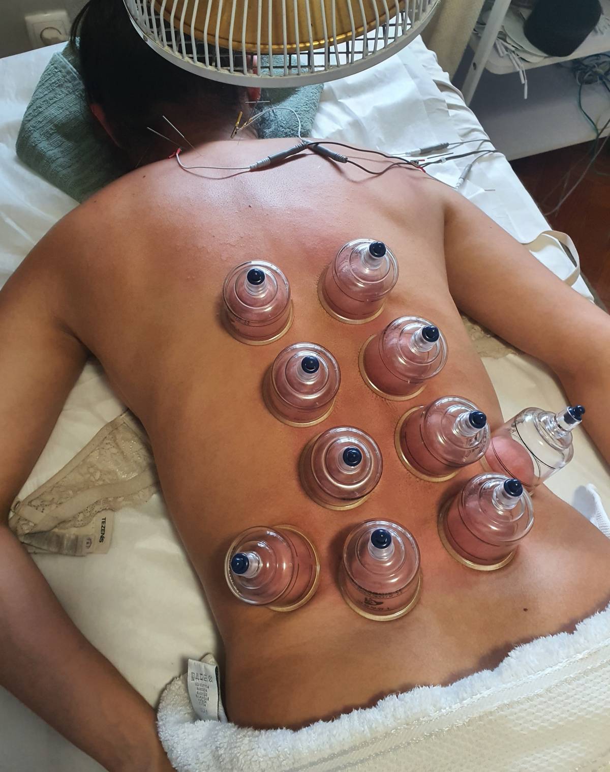 Sandra Tez MBS Therapies - Lisboa - Acupuntura