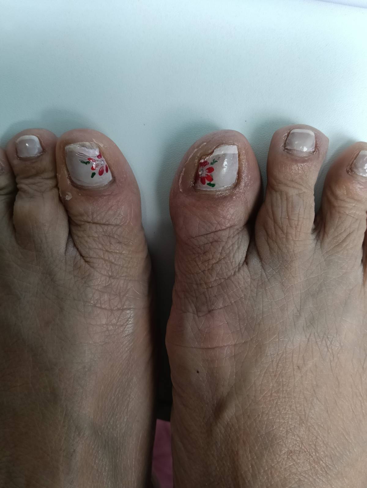 CLINIQUE Pé Su podologia - Leiria - Massagem Desportiva
