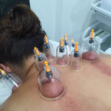 Sandra Tez MBS Therapies - Lisboa - Tratamento Facial
