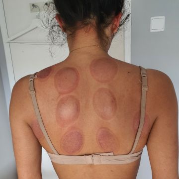 Sandra Tez MBS Therapies - Lisboa - Limpeza de Pele