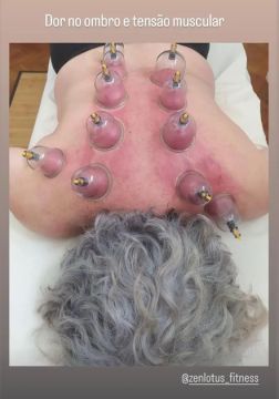 Mariana Monteiro - Seixal - Therapeutic Massage