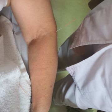 Sandra Tez MBS Therapies - Lisboa - Drenagem Linfática
