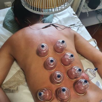 Sandra Tez MBS Therapies - Lisboa - Acupuntura