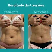 Ninja Factory - Amadora - High-Intensity Interval (HIIT) Training