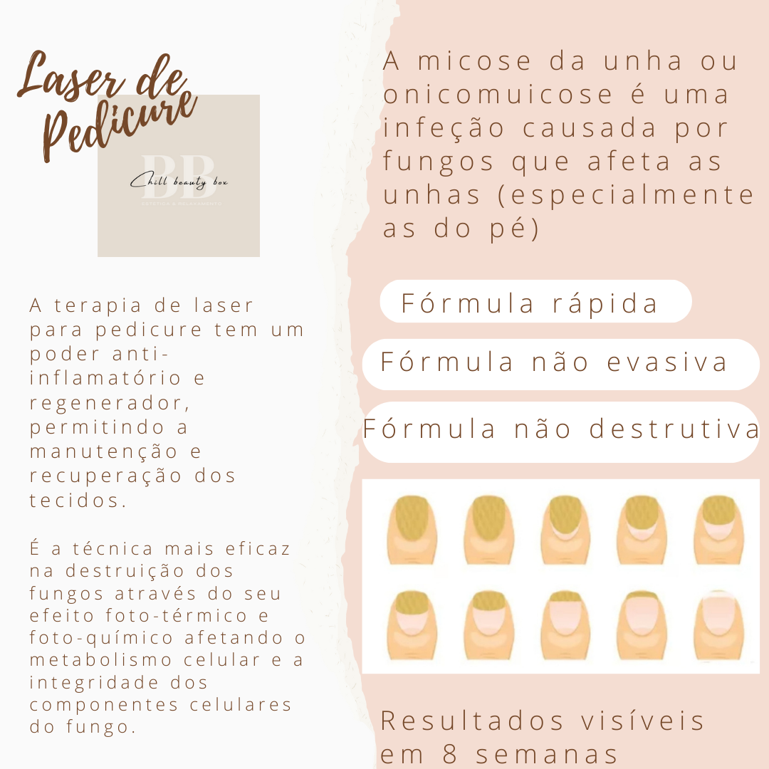 Neuza Guerreiro - Albufeira - Manicure e Pedicure (para Mulheres)