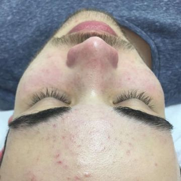 Yolanda Tomaz - Almada - Pregnancy Massage