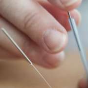 Ricardo Marques - Lousã - Acupuncture Services