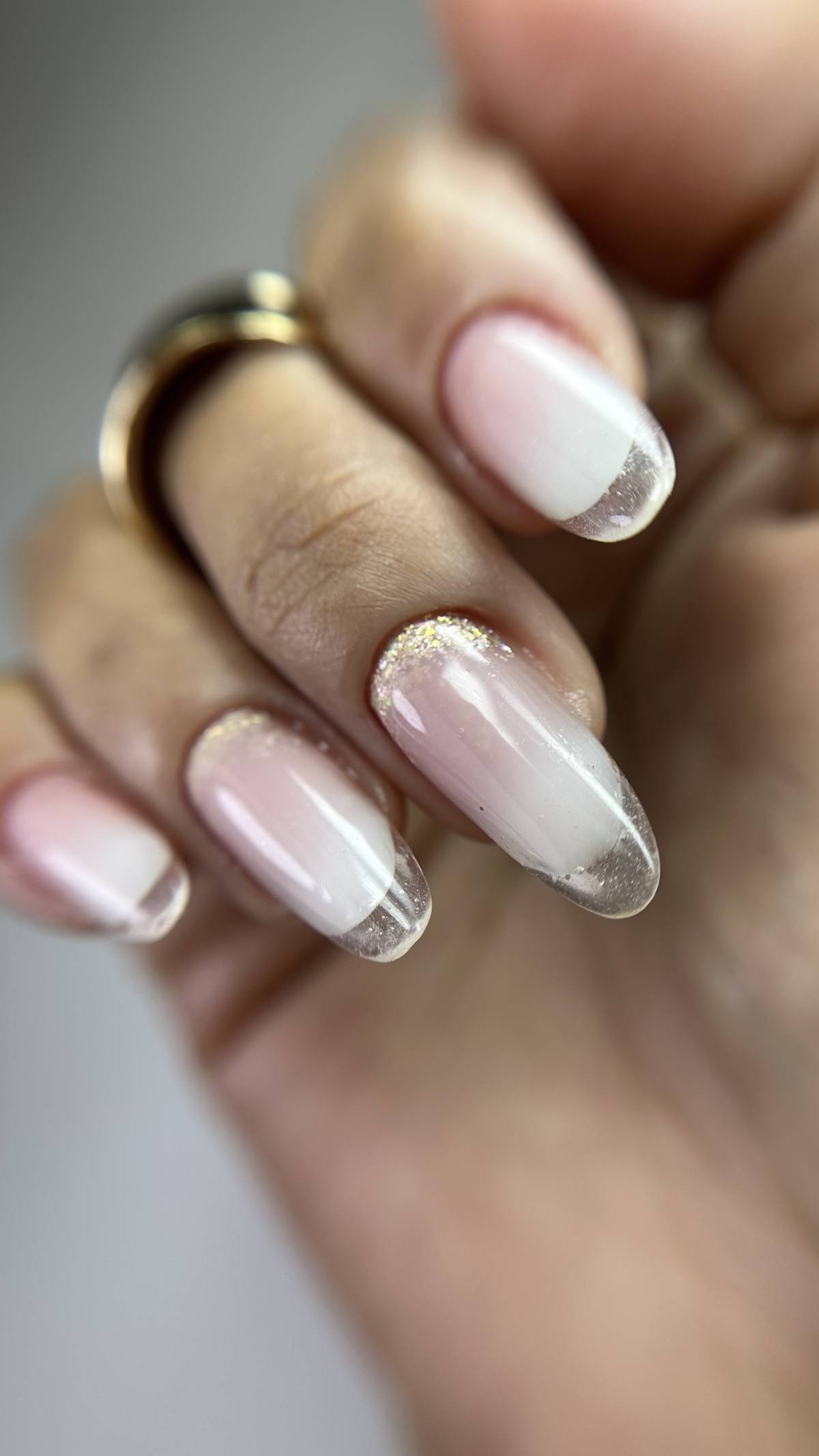 Brenda Lopes Castilho - Lisboa - Laser-Enthaarung