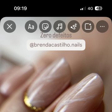 Brenda Lopes Castilho - Lisboa - Haarentfernung
