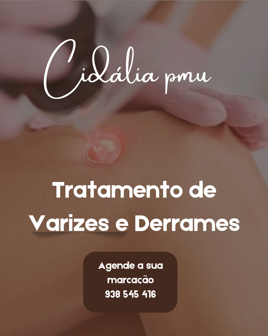 Cidália pmu - Seixal - Limpeza de Pele