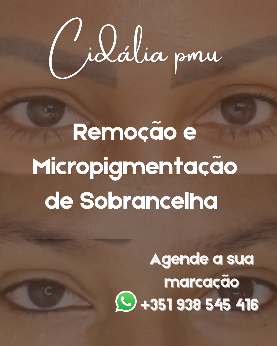 Cidália pmu - Seixal - Depilação