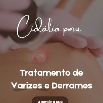 Cidália pmu - Seixal - Limpeza de Pele