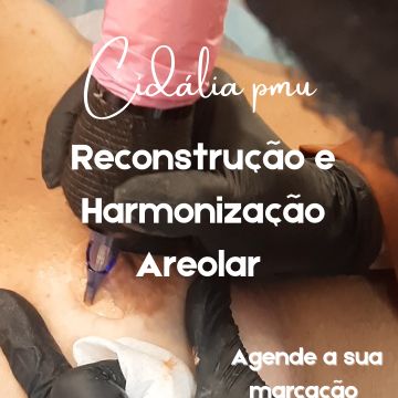 Cidália pmu - Seixal - Depilação a Laser