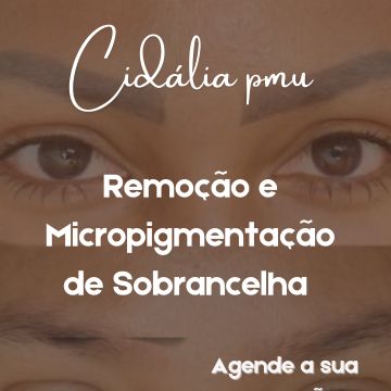 Cidália pmu - Seixal - Depilação