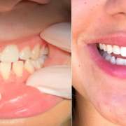 DentalArt and Medical Clinic - Portimão - Enfermagem