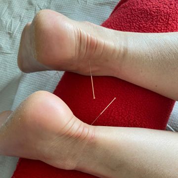 Eliane Pacheco - Porto - Acupuncture