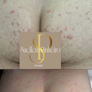 Suellem Pinheiro Studio - Santa Maria da Feira - Skin Cleansing