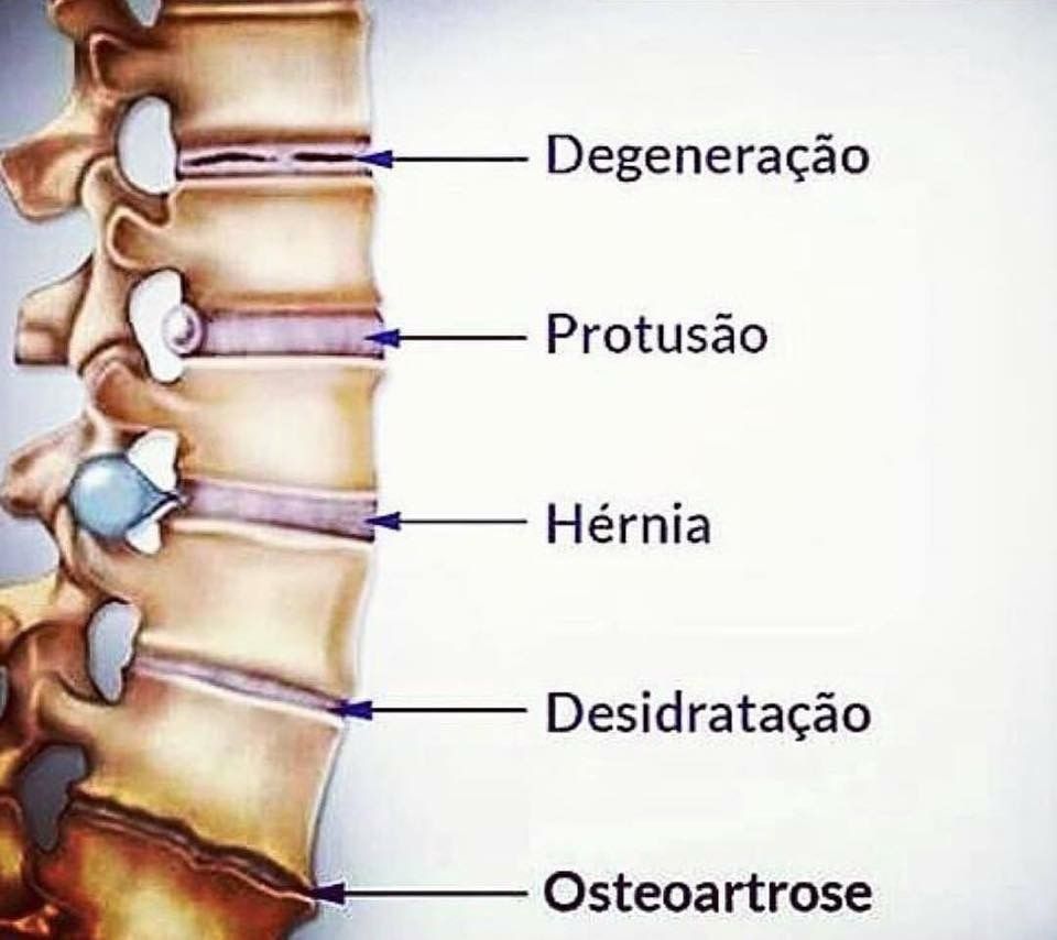 Ítalo Giordani Bortolozo - Almada - Fisioterapia