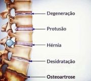 Ítalo Giordani Bortolozo - Almada - Fisioterapia