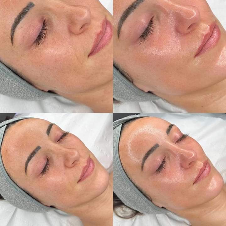 Carla Porto - Porto - Sports Massage