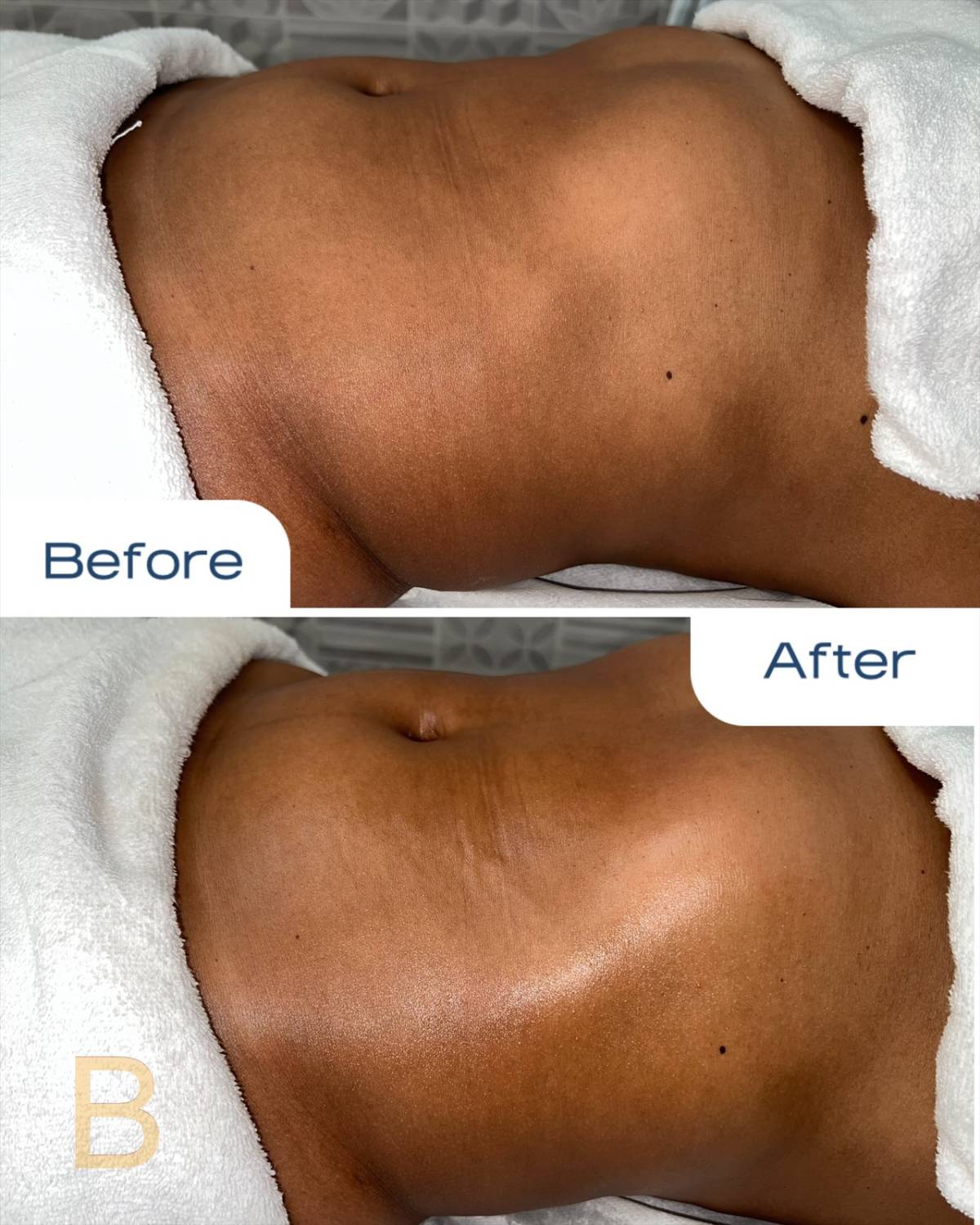 Brena esteticista - Portimão - Massagem para Grávidas