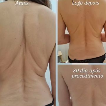 Nathalia Jácome - Oeiras - Limpeza de Pele