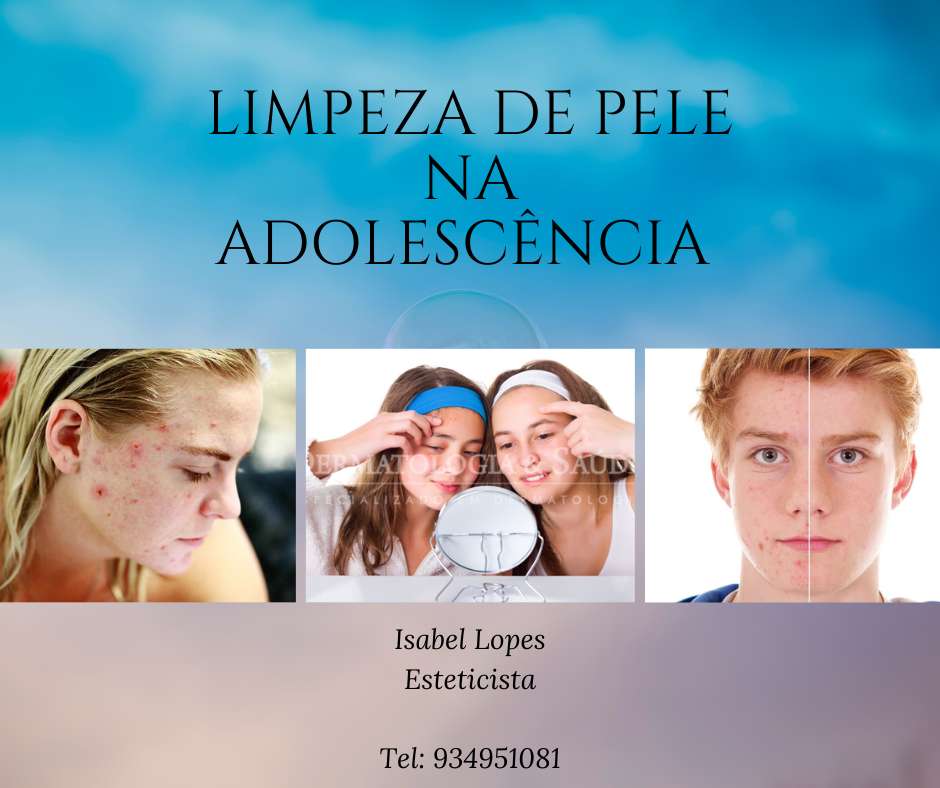 Isabel Lopes - Maia - Massagem Profunda