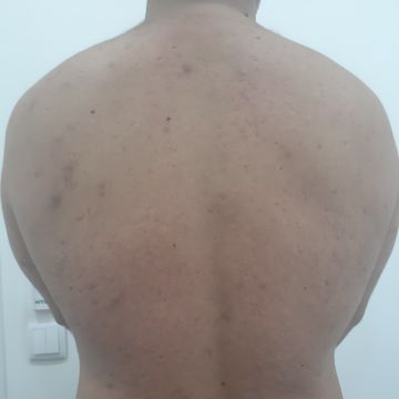 Isabel Lopes - Maia - Massagem para Grávidas