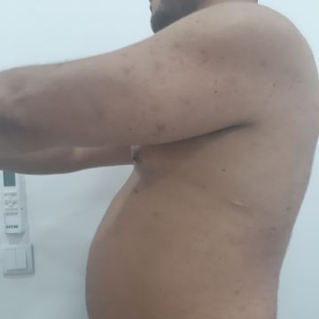 Isabel Lopes - Maia - Massagem Terapêutica