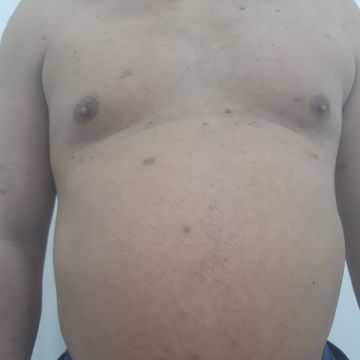 Isabel Lopes - Maia - Massagem para Casais