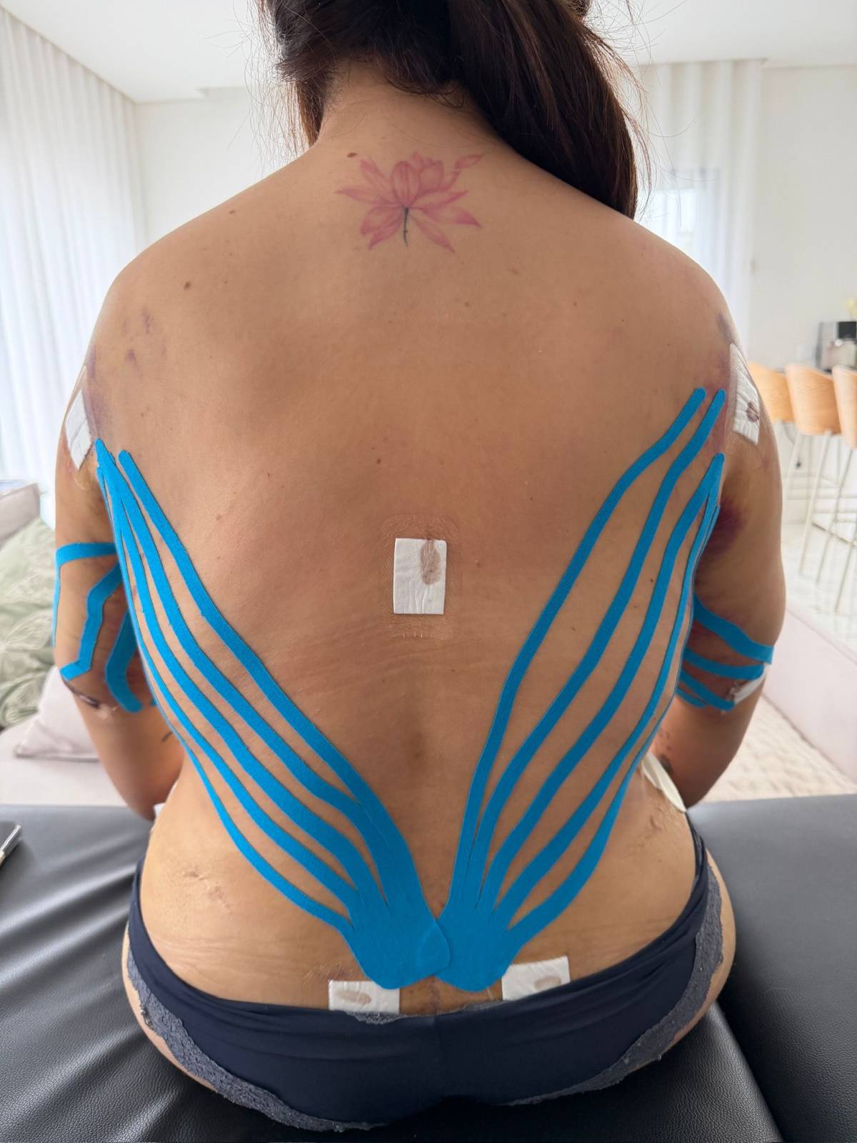 Fisio Bia Temponi - Leiria - Sessões de Fisioterapia