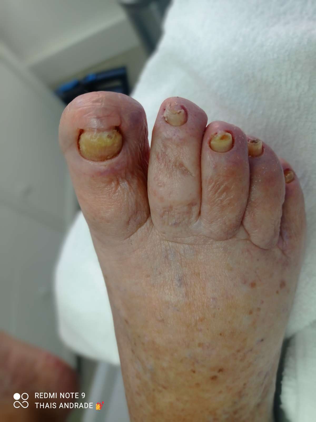 Thais Andrade - Amadora - Manicure and pedicure