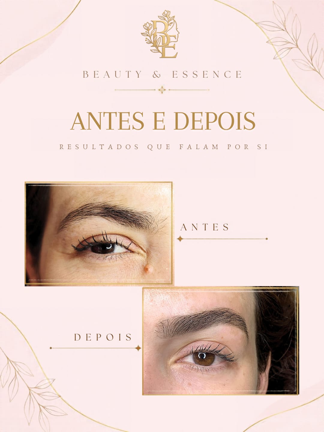 Beauty & Essence by Juliana Reis - Figueira da Foz - Centres d'épilation
