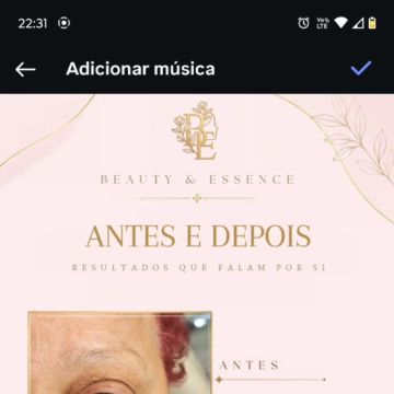 Beauty & Essence by Juliana Reis - Figueira da Foz - Épilation