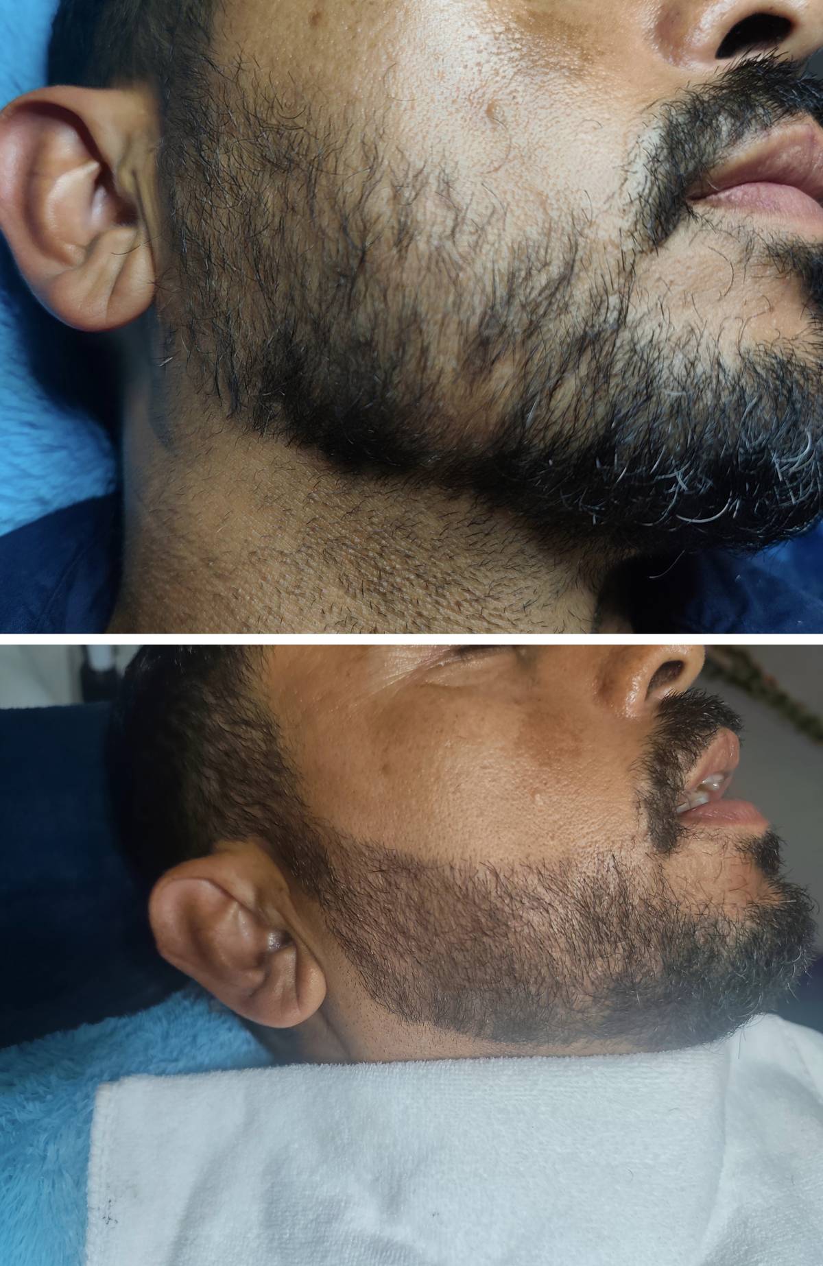 Micropigmentação e estética - Maia - Massagem Terapêutica