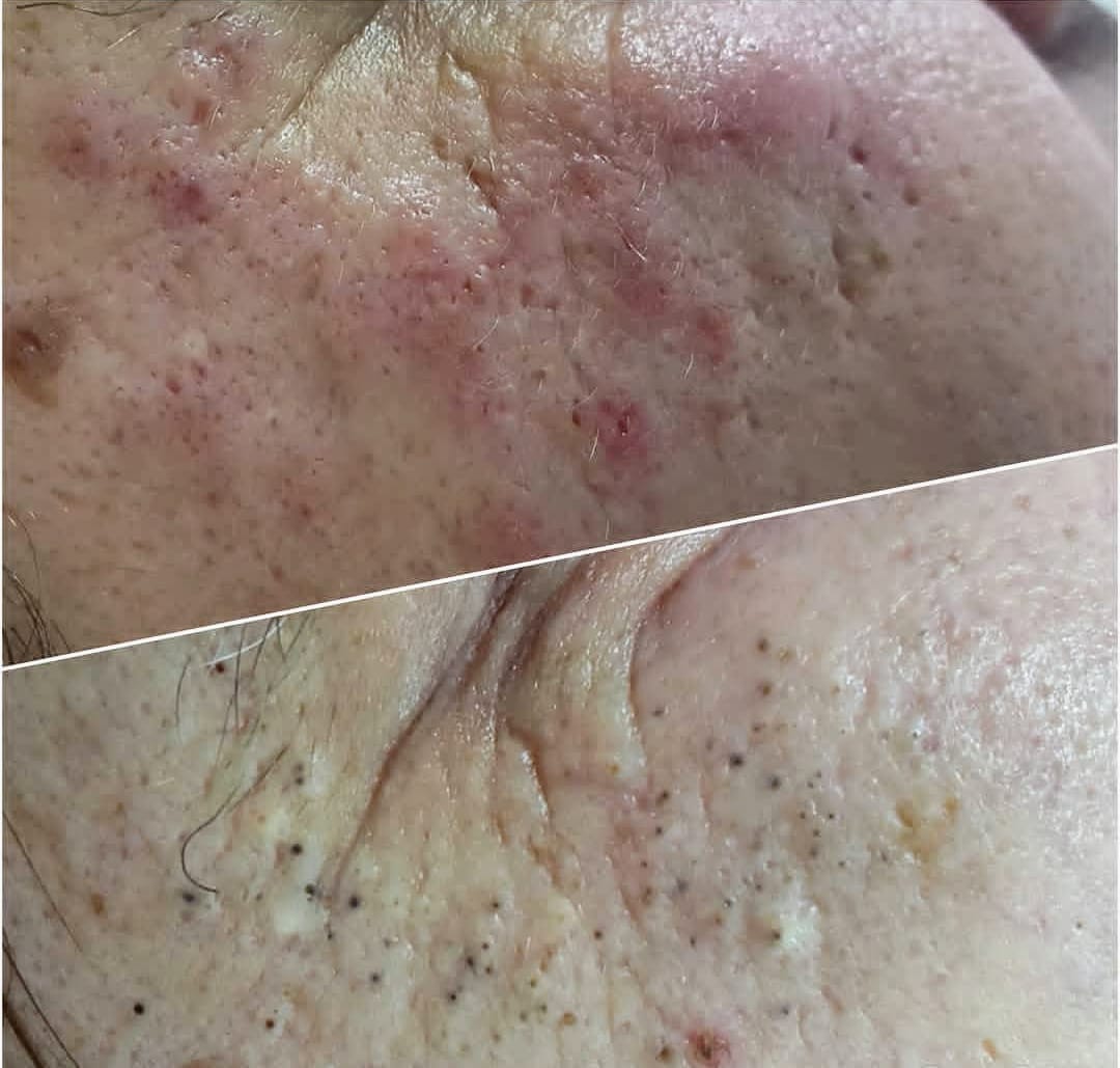 Micropigmentação e estética - Maia - Manicure e Pedicure