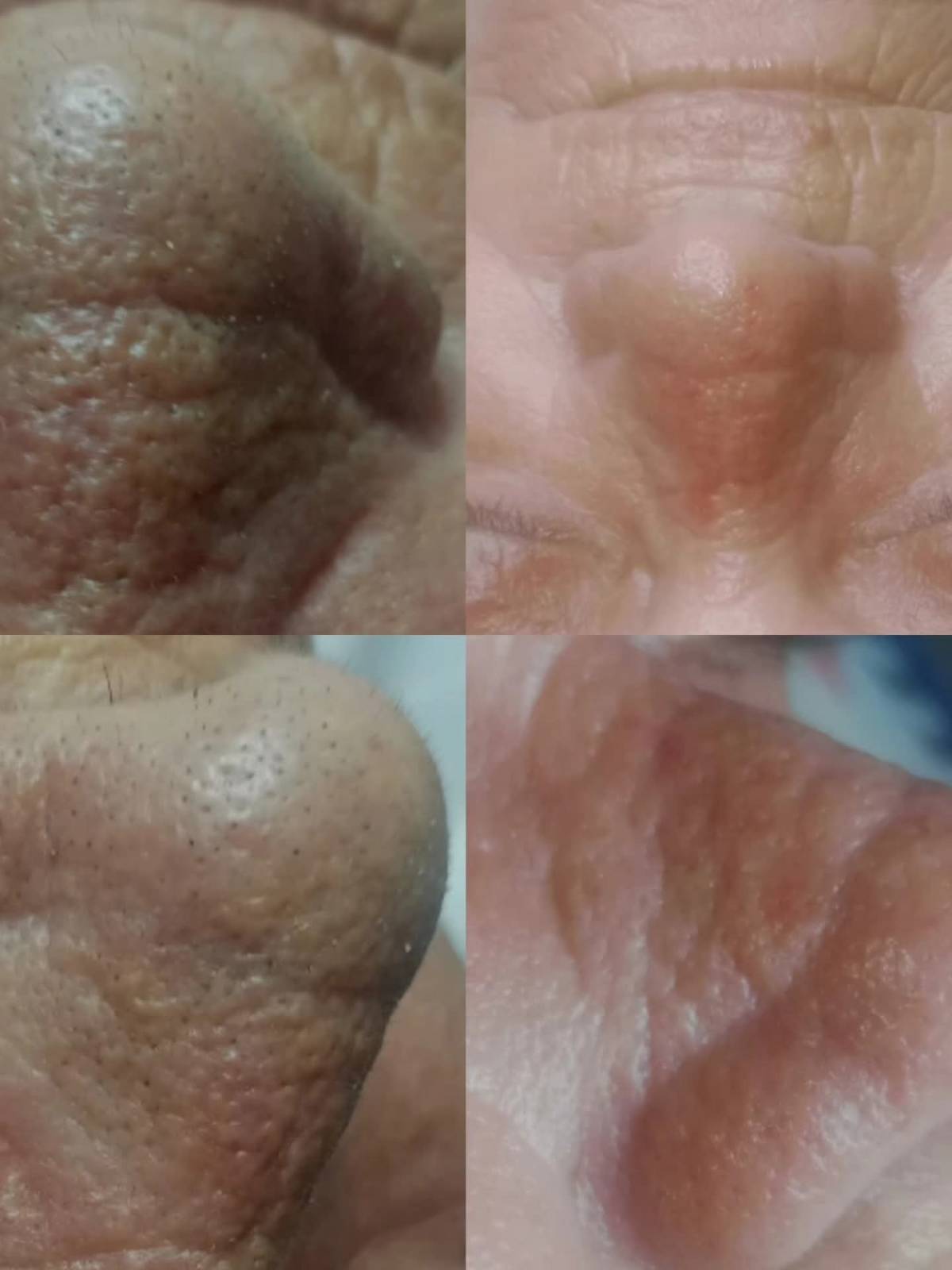 Micropigmentação e estética - Maia - Massagens