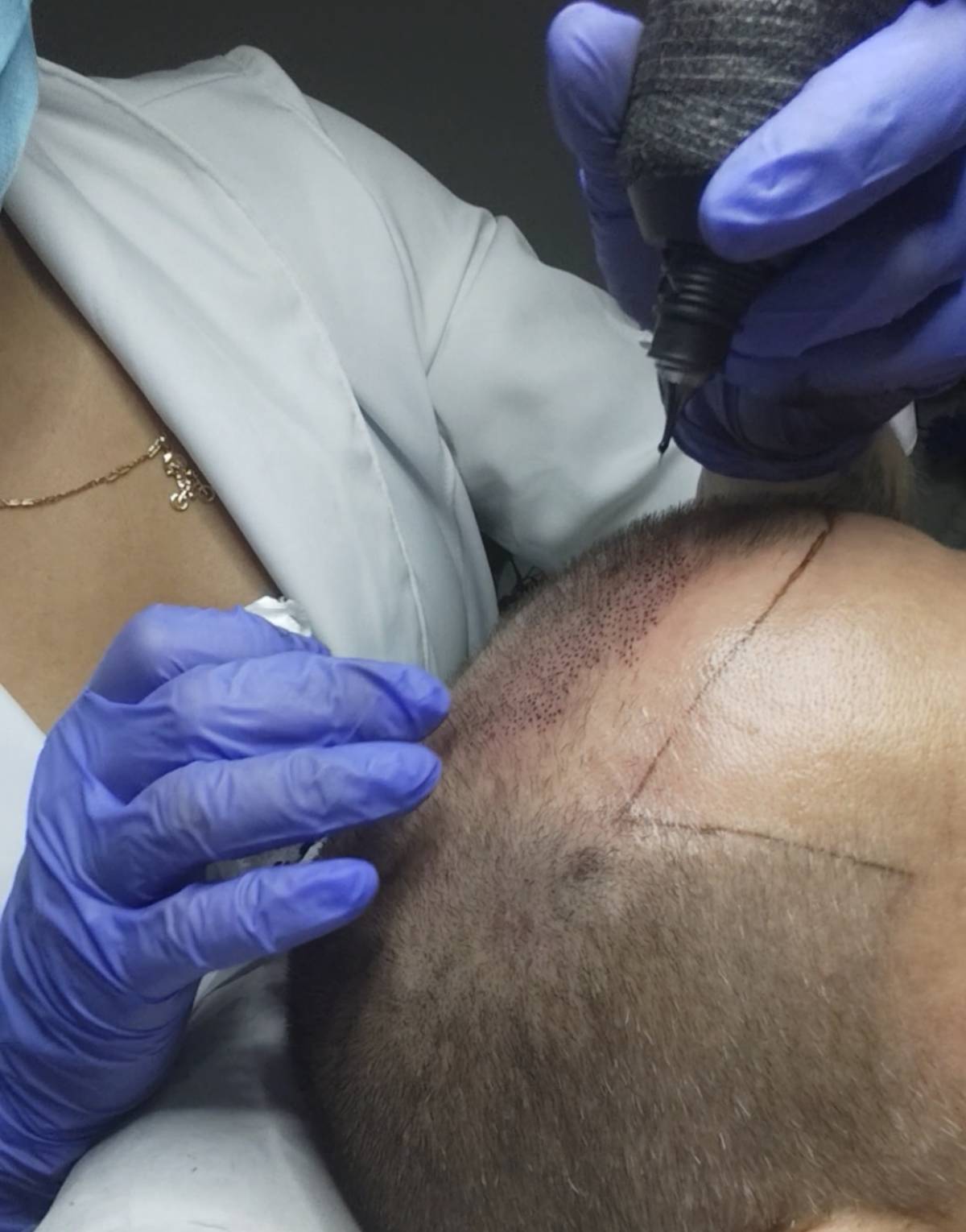Micropigmentação e estética - Maia - Investigação Privada