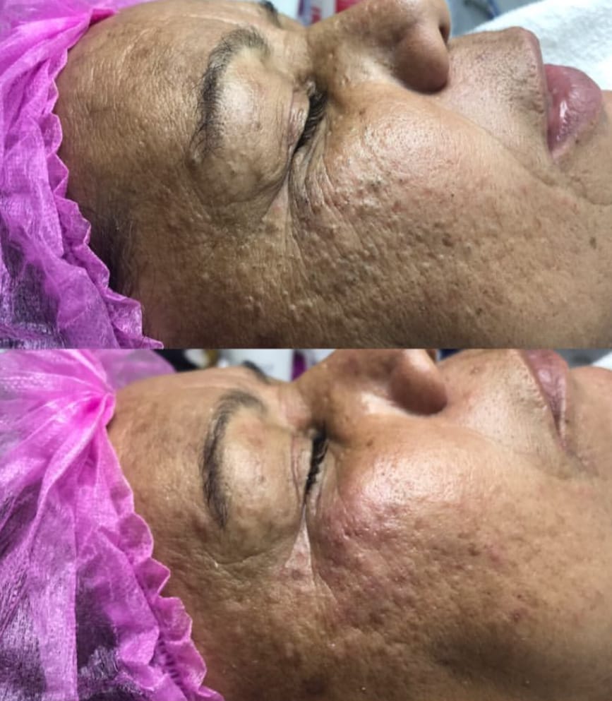 Micropigmentação e estética - Maia - Beleza