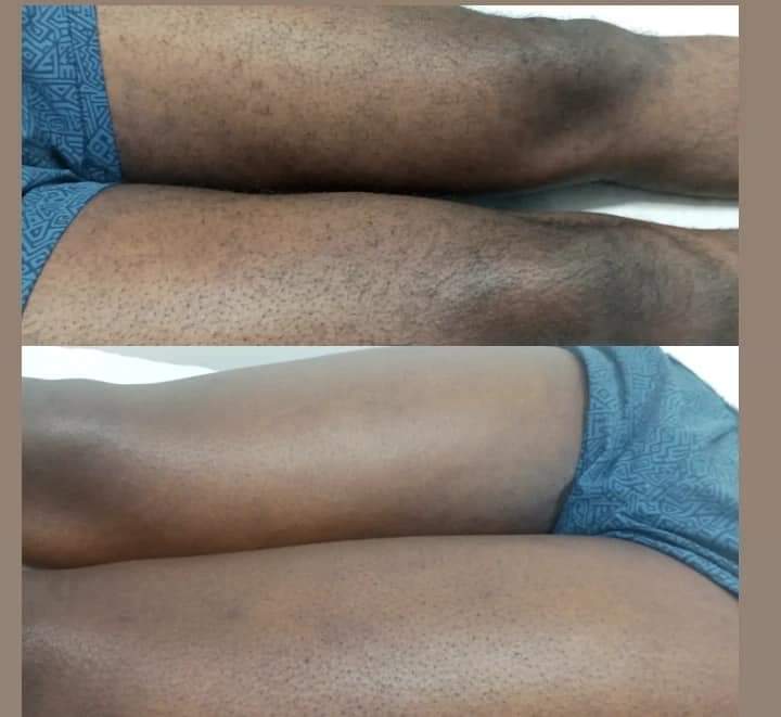 Massoterapia e Estética - Maia - Lymphatic Drainage