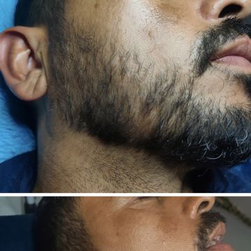 Micropigmentação e estética - Maia - Massagem Terapêutica