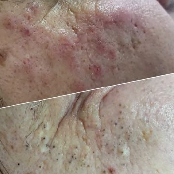 Micropigmentação e estética - Maia - Manicure e Pedicure