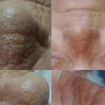 Micropigmentação e estética - Maia - Massagens